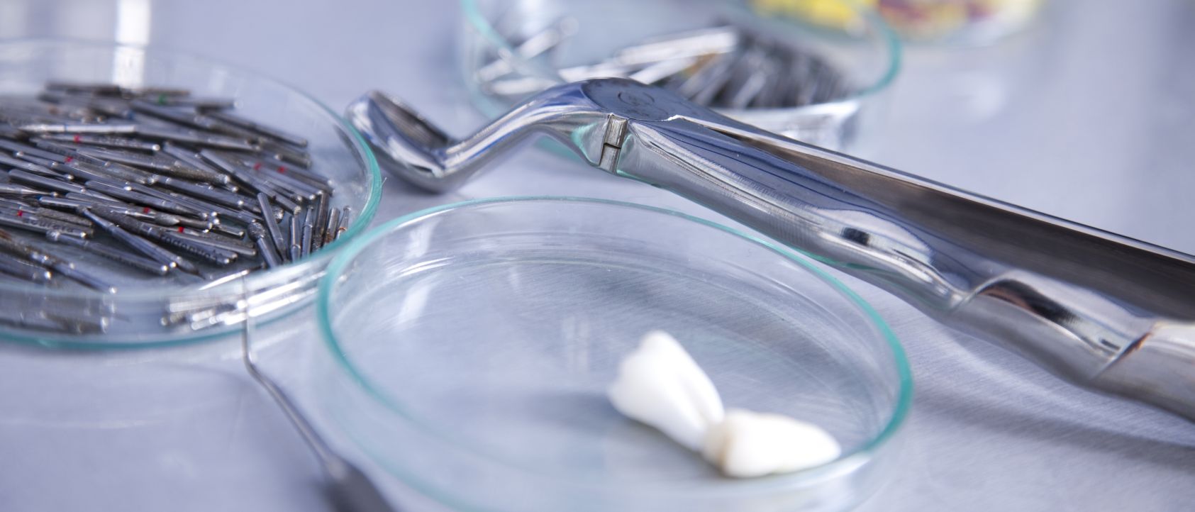 dantų implantų istorija